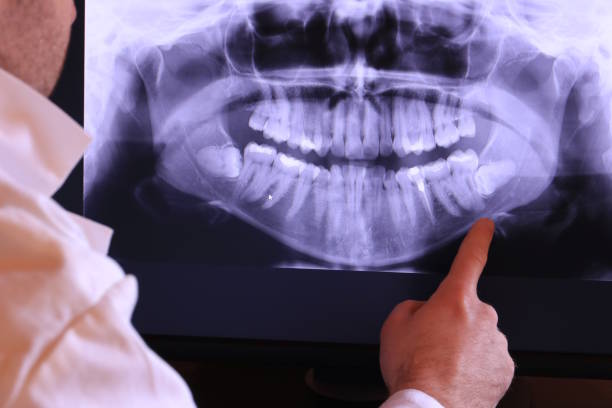 Best Emergency Tooth Extraction  in Wakefield, KS