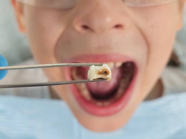Best Cracked Tooth Emergency Dentist  in Wakefield, KS